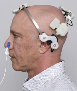 Estimulación repetitiva supramáxima